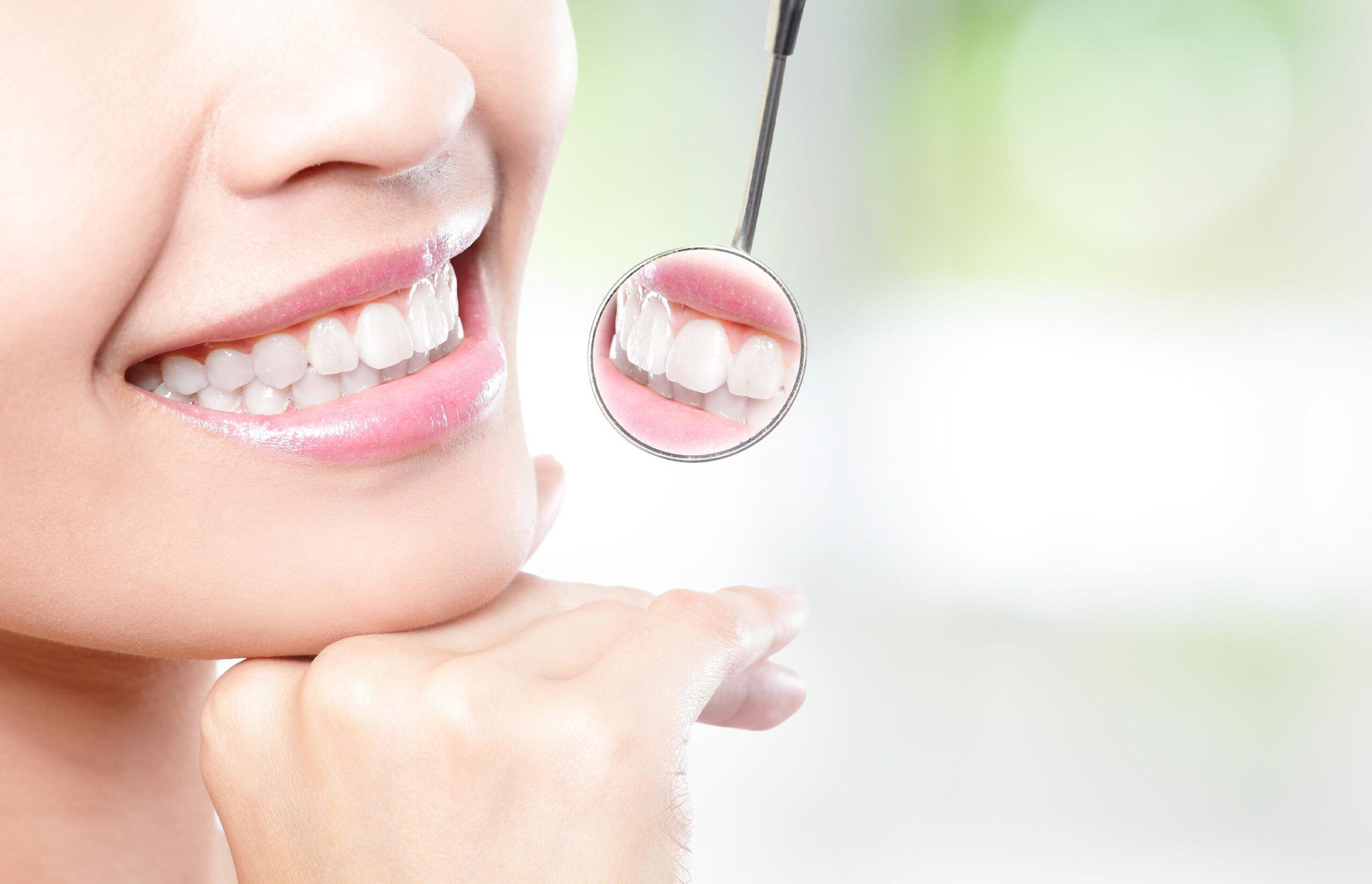 is-teeth-whitening-right-for-you-teeth-whitening-victoria-trail-dental-general-family-dentist-edmonton-alberta